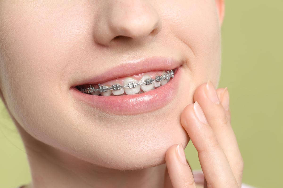 Smiling woman with braces